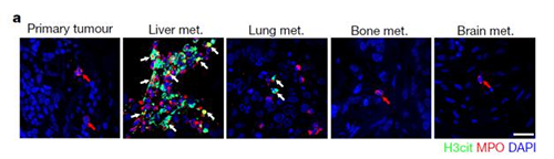 转入小鼠模子获得相同的试验效果，，且在转移爆发前NET已在肝脏聚积。。。
