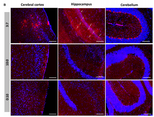 被包裹在含有NT-类脂质的LNP中的Cre重组酶乐成转移。。。。。。大脑中的转染神经元呈红色高亮。。。。。。
